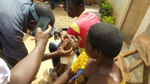 Ophthalmology technician exams child's eye to check for trachoma in Côte d’Ivoire. Photo: FHI 360